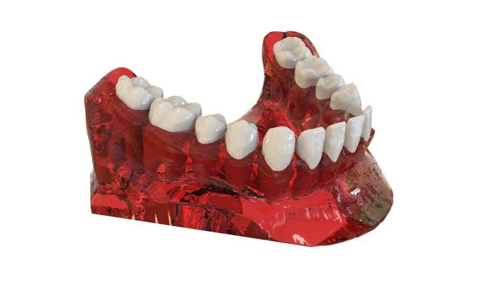 teeth, jaw, 3d model, orthodontics, the implant, teeth, teeth, jaw, jaw, jaw, jaw, jaw